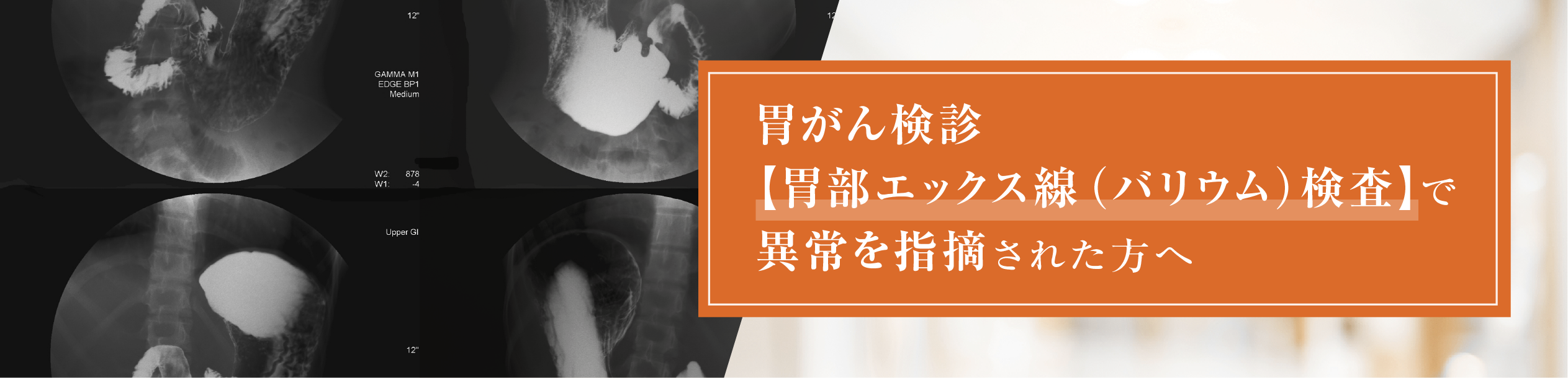 胃がん検診